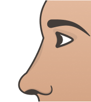 Button (Celestial) Nose